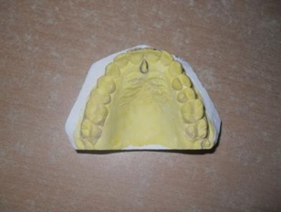Fig 2: Prepared cast