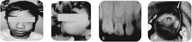Figure-1: Initial clinical condition with radiograph