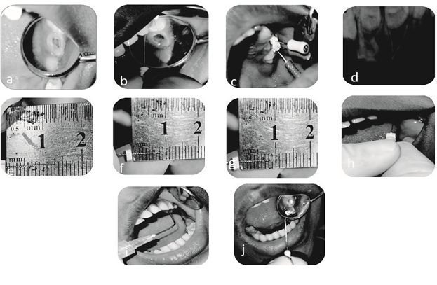 Figure-2: Operative procedures